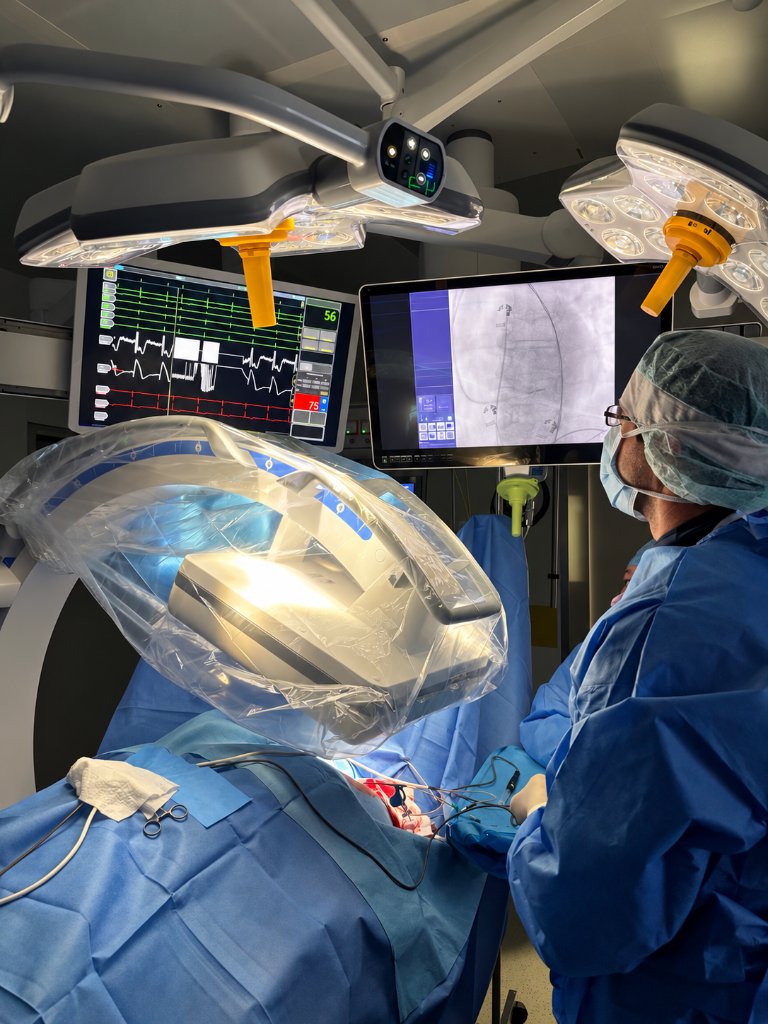 Physiological conduction system pacing procedure at the Cardiology Department